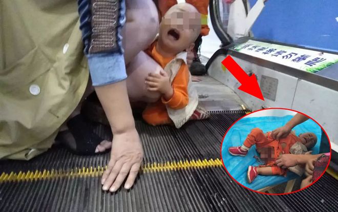 Bé trai dưới 2 tuổi bị kẹt bộ phận sinh dục ở thang cuốn siêu thị