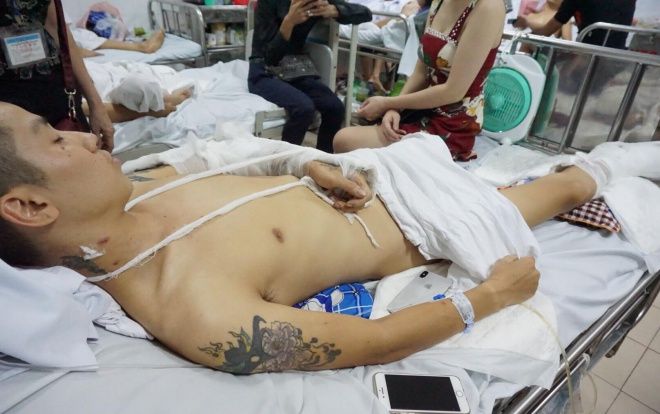 Vụ nam thanh niên bị nhóm đối tượng bịt mặt chém nát chân trong đêm: Nghi vấn có người thuê sát thủ từ nơi khác đến truy sát