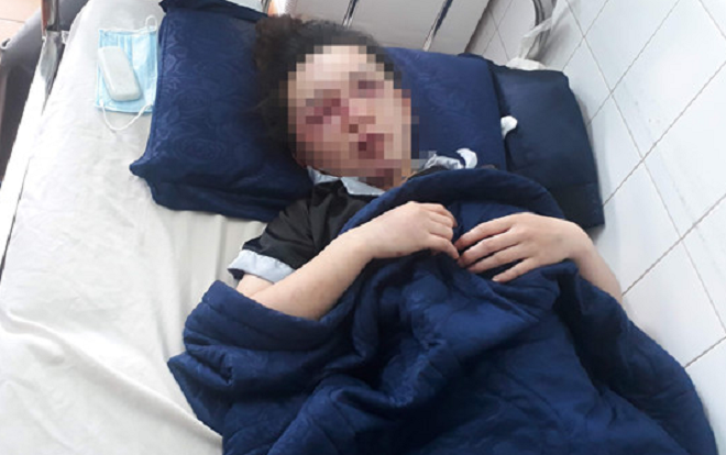 Đang làm việc tại thẩm mỹ viện, cô gái bất ngờ bị nhóm người bắt lên taxi đánh dã man vào vùng mặt