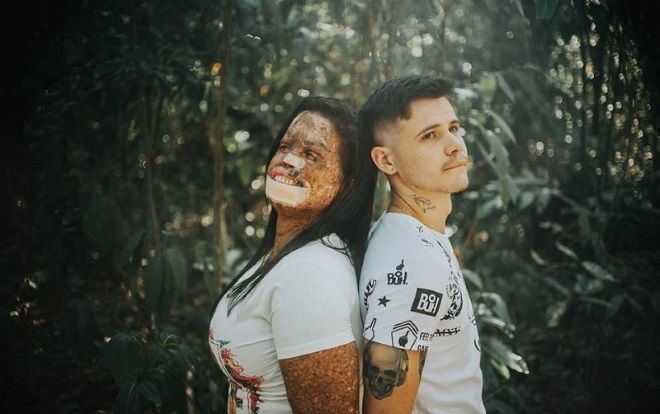 Bộ ảnh tình yêu chàng trai dịu dàng ôm chặt cô gái có hình hài xấu xí gây sốt mạng xã hội