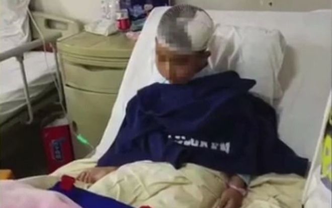 Chưa chính thức làm mẹ kế, người phụ nữ đã cầm búa đập vỡ đầu con riêng của chồng