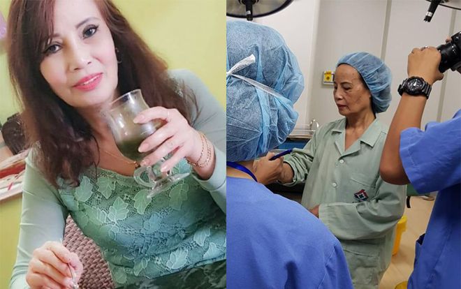 Mong muốn trẻ ra 20 tuổi, cô dâu 61 quyết thực hiện cuộc  'đại tu' hút mỡ bụng, cấy mỡ mắt