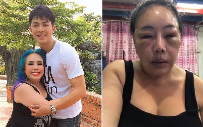 Sốc với gương mặt sưng vù của nữ đại gia từng 1 năm thay 6 đời chồng mà lần nào cũng phi công trẻ cao ráo điển trai