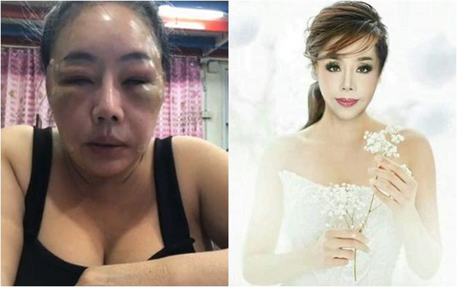 Nữ đại gia 14 đời chồng đã 'lột xác' như gái đôi mươi nhưng lý do cuộc trùng tu nhan sắc này mới thật sự khiến người ta kinh ngạc