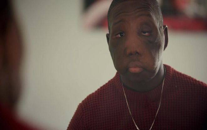 Cuộc đời bi thương của cậu bé 'quái vật' bị mẹ đẻ bỏ rơi