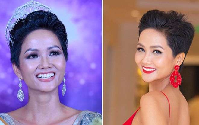 Cái 'kết ngọt' sau khi chỉnh nha đau đớn của hoa hậu H'Hen Niê