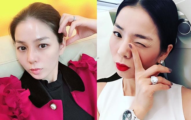 Mũi sưng to đau nhức, Lệ Quyên phải vội vã tháo sụn mũi giả để tránh hoại tử