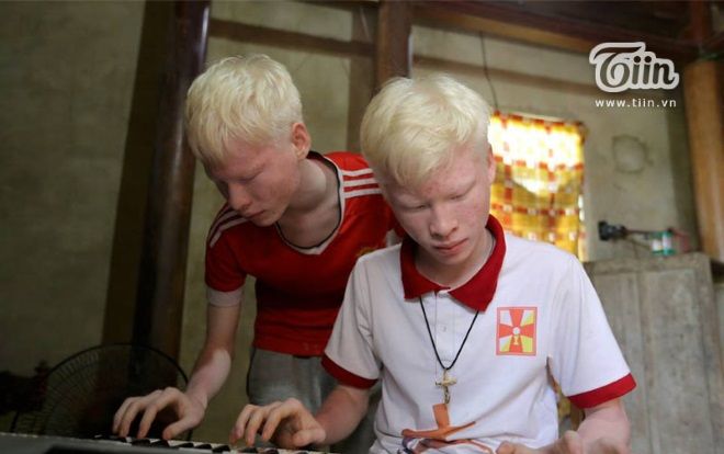 Nghị lực cặp song sinh bạch tạng ở Hà Tĩnh: Dang dở việc học, bán đàn vì nghèo vẫn lạc quan