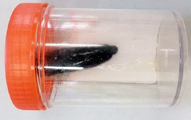 Kinh hãi đỉa chui vào đường thở cháu bé 9 tuổi