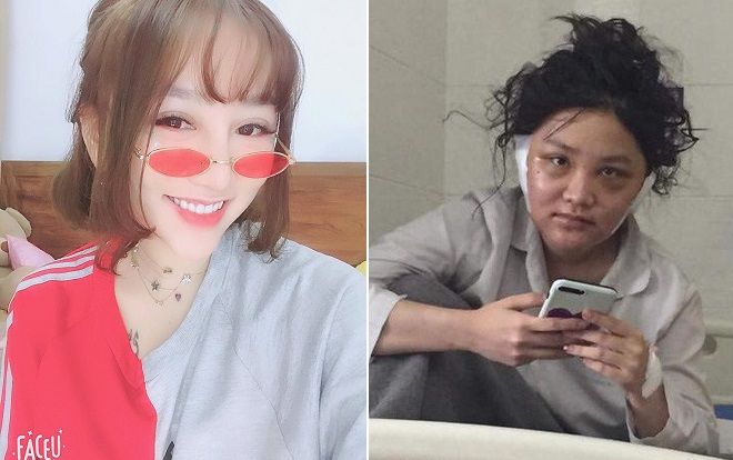 Kiều Anh Hera trở lại 'lợi hại hơn xưa' sau khi lộ khuôn mặt sưng phù hậu PTTM