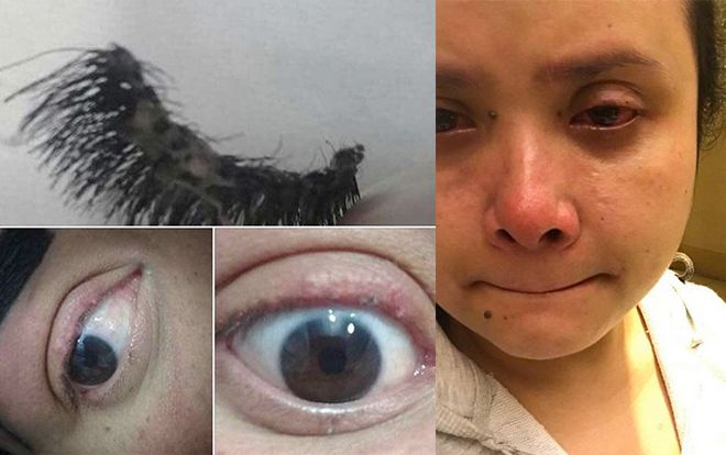 Thêm 1 vụ nối mi giả mất luôn mi thật, cô gái trẻ không dám ra đường gặp ai, chỉ biết than trời