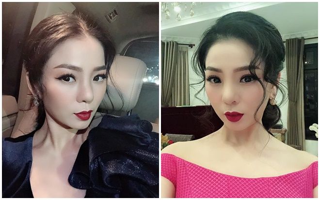 Lệ Quyên cập nhật tình hình sau khi tháo sụn mũi