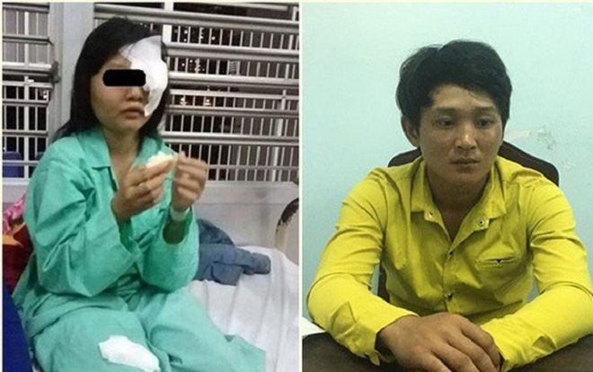 'Yêu râu xanh’ đánh nữ sinh 15 tuổi mù mắt để giở trò đồi bại sa lưới