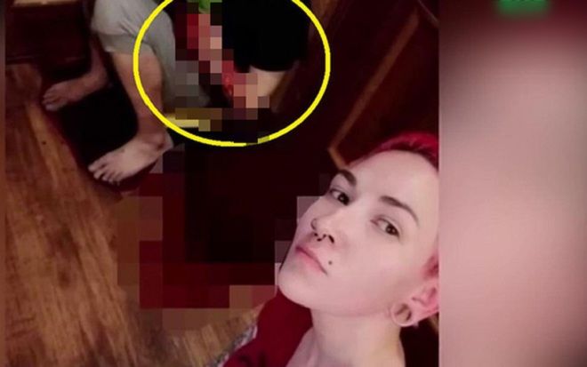 Đăng ảnh ‘tự sướng’ khoe bạn bè sau khi đâm chồng cũ chảy máu bụng phải cấp cứu