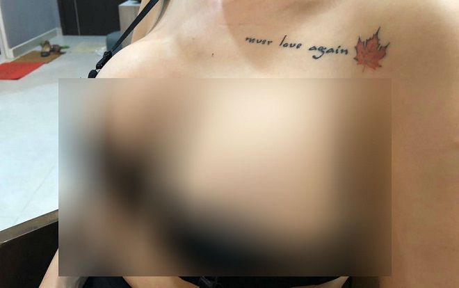 Vụ vỡ túi ngực 2.000 USD trên máy bay: Nguyên nhân có thể do chất lượng sản phẩm kém