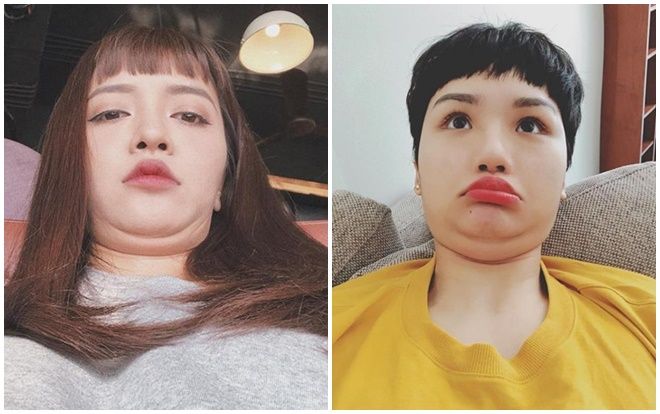 Xử lí nọng cằm không cần phẫu thuật thẩm mĩ bằng các mẹo đơn giản