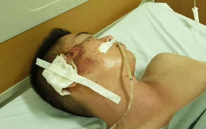 Tài xế Mazda CX5 dùng súng bắn thủng bụng, chèn qua người lái taxi từng có 6 tiền án