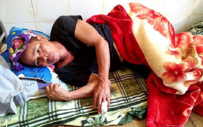 Lợn rừng nặng gần 1 tạ bất ngờ xuất hiện tấn công người dân, cụ ông 63 tuổi bị húc thủng bụng