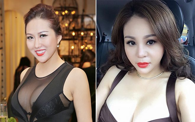 Cứ ngỡ Phi Thanh Vân phẫu thuật thẩm mỹ nhiều nhất, hóa ra 2 sao nữ này còn chẳng nhớ nổi số lần dao kéo