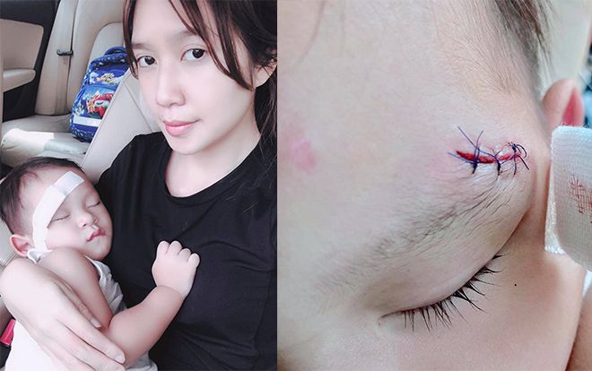 Con bị ngã rách đầu, bà xã Lý Hải xót con vô cùng, nhưng ơ kìa, sao vết thương lại biết chạy thế kia?