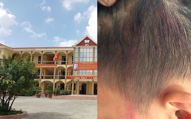 Xác minh vụ cô hiệu phó túm tóc học sinh đập đầu vào tường vì vẽ bậy lên tường của lớp