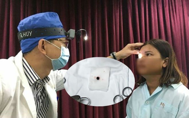 Đang đứng trước nhà, người phụ nữ bất ngờ bị đạn ghim thẳng vào hốc mắt phải