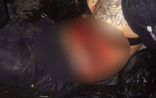 Ăn cắp tiền bị phát hiện, nam thanh niên nhảy xuống ao thoát thân thì bị vật nhọn đâm trọng thương