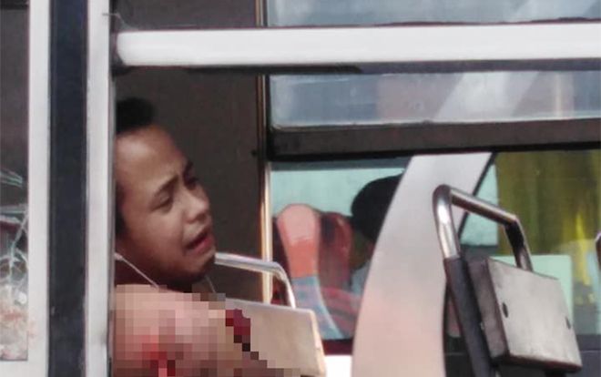 Thanh niên mất cả cánh tay chỉ vì thói quen mà rất nhiều người hay mắc phải khi đi xe buýt