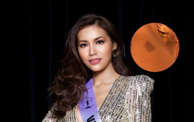 Fan lo 'sốt vó' về tình hình Minh Tú tại Miss Supranational 2018: Vỡ mạch máu, mỗi ngày chỉ ngủ 3 tiếng