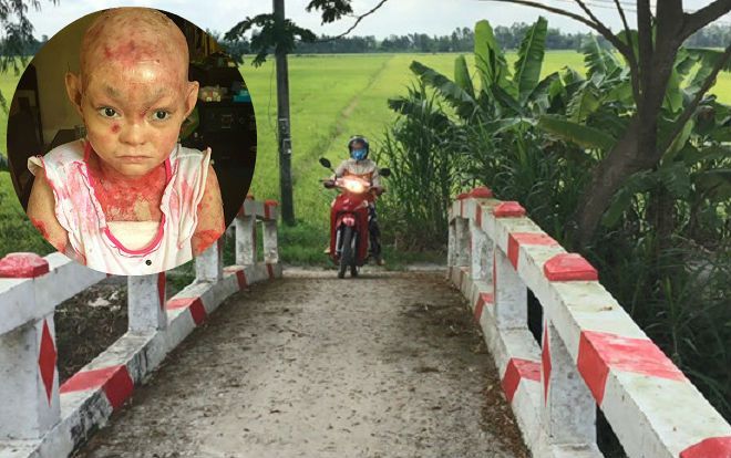Cô gái bị bệnh nan y đem hết tiền nhà hảo tâm tặng xây cây cầu giúp dân
