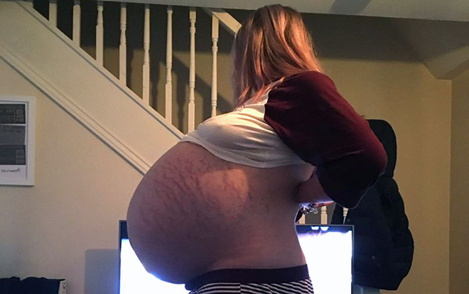 Tưởng mang bầu sắp đẻ, cô gái đi khám mới phát hiện ra sự thật kinh hoàng