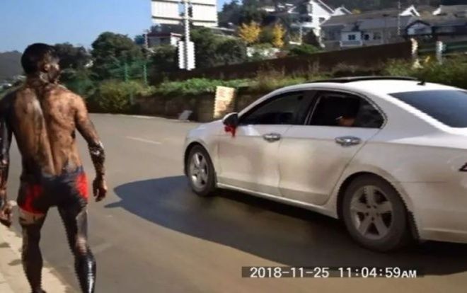 Chú rể toàn thân dính mực, bị xe tông trúng khi chạy trốn khỏi đám cưới