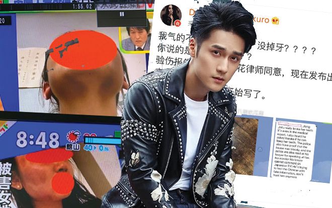 Bạn gái bị bạo hành tiết lộ thói quen hành hung đáng sợ của Tưởng Kình Phu