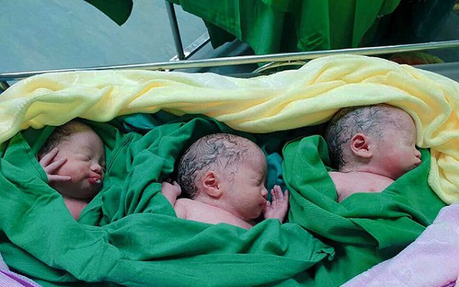 Sản phụ mang tam thai hiếm gặp, vượt cạn thành công sinh ra 3 bé gái
