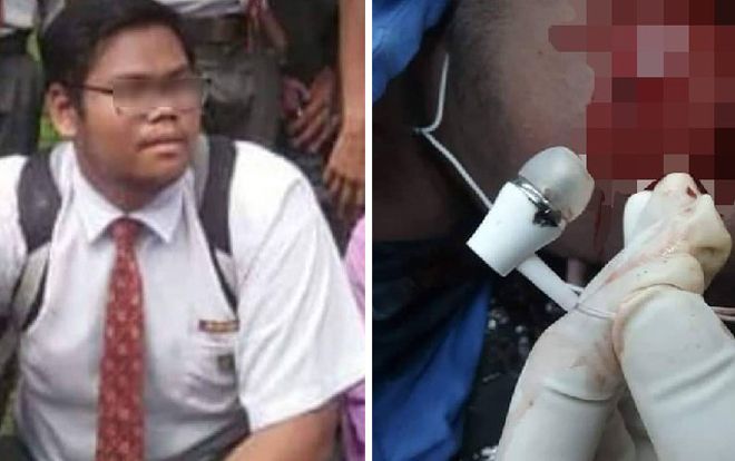 Sạc điện thoại rồi đeo tai nghe khi ngủ, thiếu niên 16 tuổi mất mạng