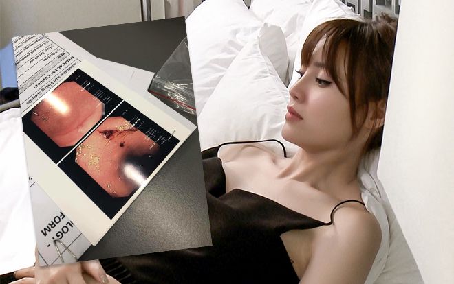 Lộ ảnh nội soi loét chảy máu dạ dày của Ninh Dương Lan Ngọc vì nhịn ăn, ép cân khi đóng phim