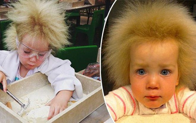 Kỳ lạ bé gái 8 tuổi có mái tóc 'dựng đứng' giống nhà bác học thiên tài Albert Einstein