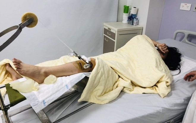 Đã bắt được tài xế ô tô Range Rover tông gãy chân nữ sinh 19 tuổi ở ngã tư phố Bà Triệu