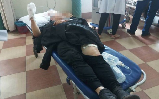 Ông chủ quán ăn bị người xe ôm chém đứt bàn tay