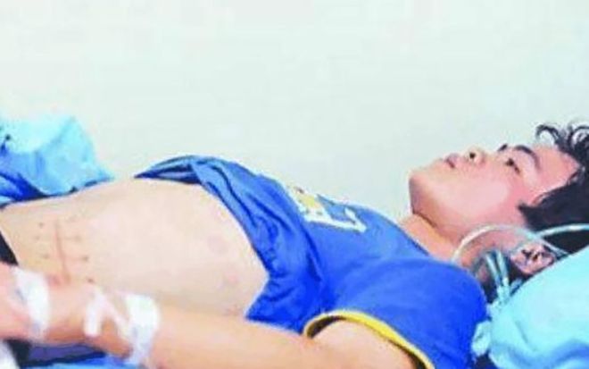 Bán thận mua iPhone năm 17 tuổi, thanh niên Trung Quốc phải nằm giường bệnh suốt 7 năm ròng