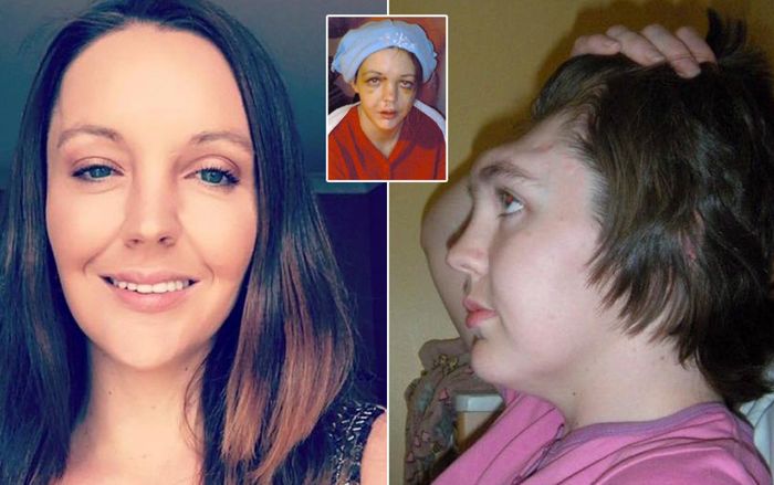 Cô gái xinh đẹp bị tổn thương não chỉ vì thói quen rất nhiều người mắc phải khi đi ô tô