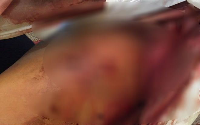 Người đàn ông tử vong bất thường, trên người có nhiều vết khoanh tròn nghi do súng bắn