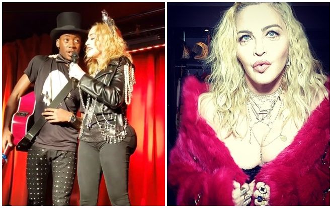 Không chỉ bơm mông quá đà, Madonna từng tiêm filler đến biến dạng để níu kéo tuổi xuân