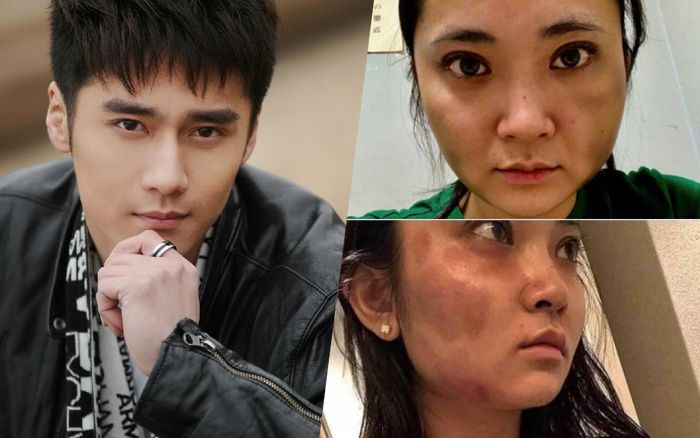 Bạn gái cũ Tưởng Kình Phu lên tiếng: Chấp nhận xử phạt không khởi tố đối với Tưởng Kình Phu