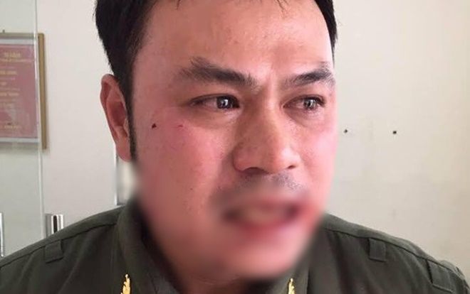 Nhân viên an ninh sân bay Nội Bài bị đối tượng cò mồi hành hung, đánh gãy 4 cái răng