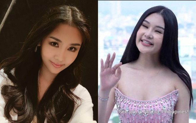 Gương mặt bỗng thon gọn đến lạ, Lê Âu Ngân Anh bị nghi photoshop 'nát chuột'