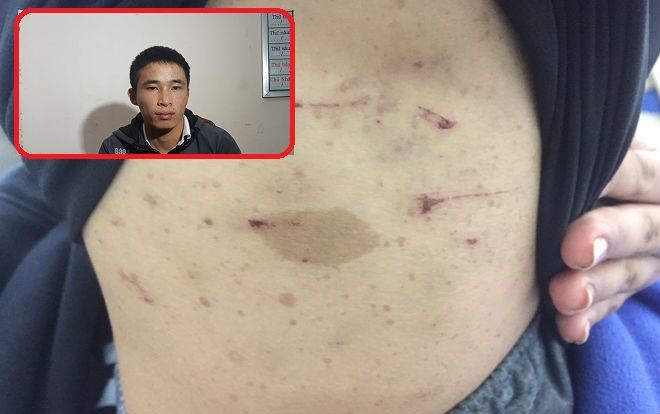 Thêm 1 vụ tra tấn dã man như thời trung cổ: Ông trùm chuyên 'điều đào' dùng kéo hành hạ nhân viên suốt 2 ngày trời