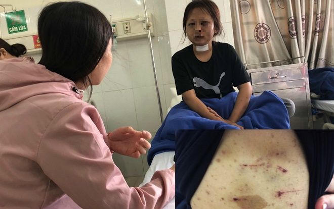 Vụ thiếu nữ 17 tuổi bị tra tấn dã man như thời trung cổ: Bắt khẩn ông trùm 'điều đào' quán karaoke