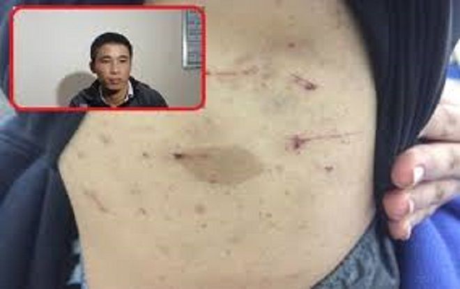 Vụ nhân viên quán karaoke bị tra tấn dã man như thời trung cổ: Đề nghị khởi tố ông trùm 'điều đào' 3 tội danh