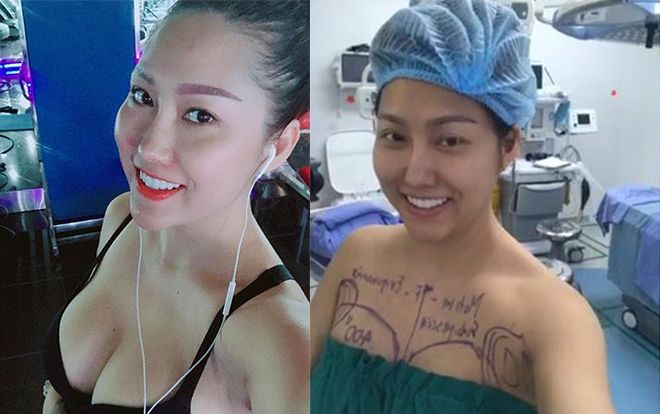 Nóng bỏng và xinh đẹp, ai mà biết được Phi Thanh Vân đã phải trải qua những ca đại tu tiền tỉ